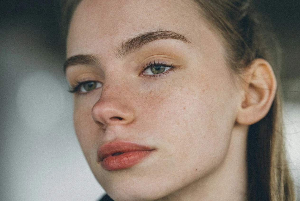 Everything about hormonal acne: causes, diagnosis and treatment