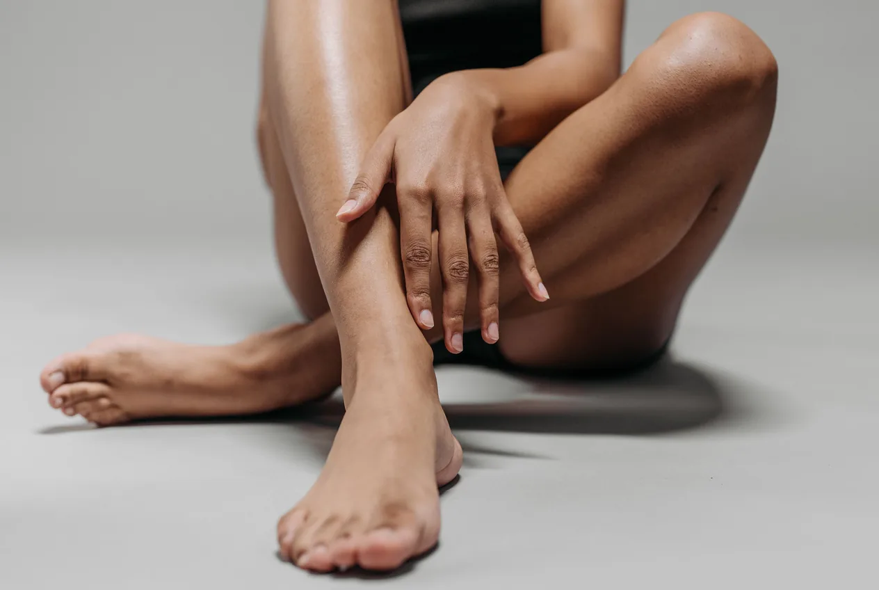 Aesthetic cellulite (orange-peel skin)