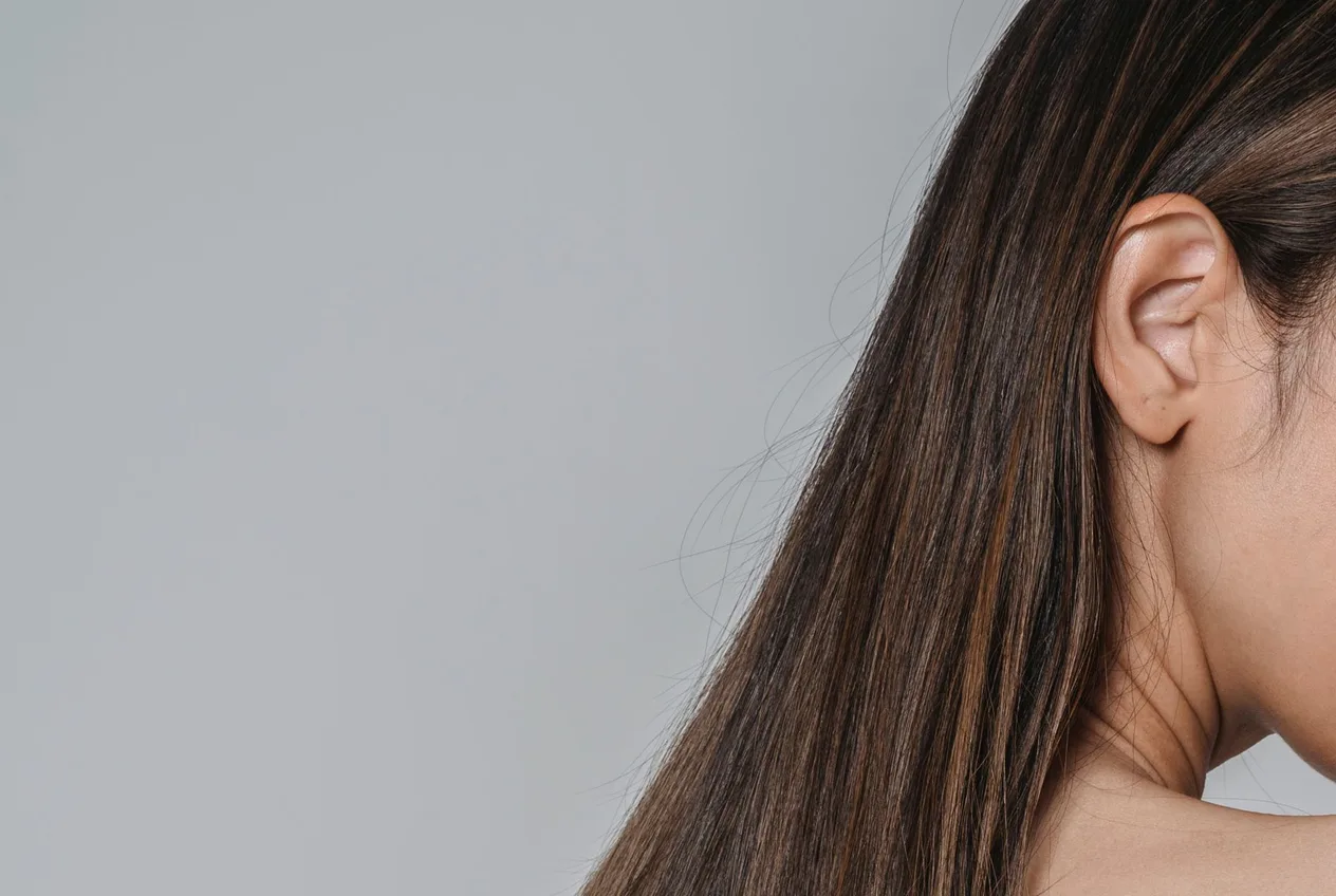 Iron deficiency and hair health