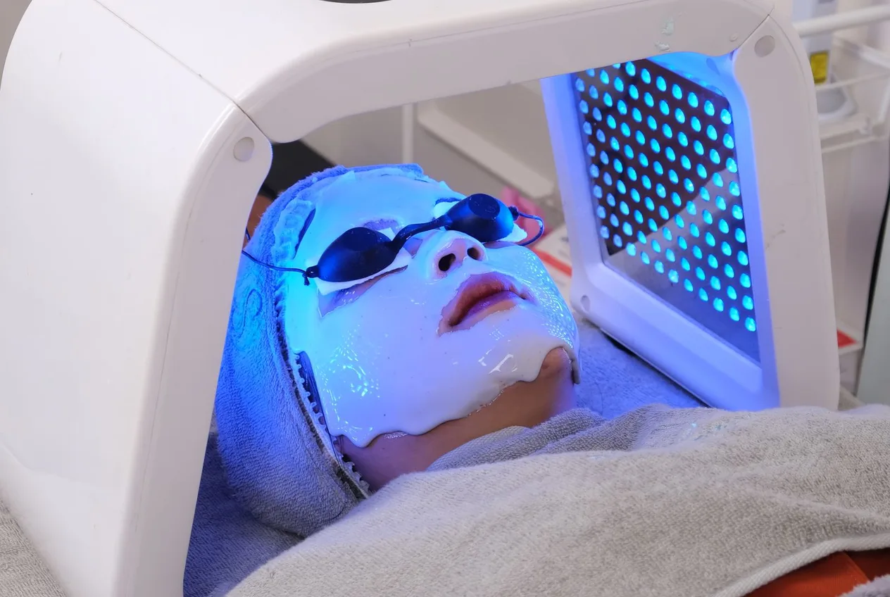 Lumière Pulsée Intense (IPL)