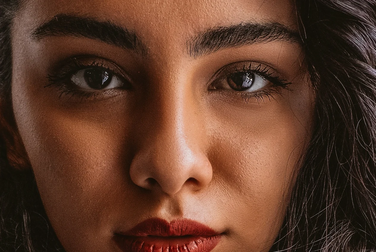 Pores dilatés