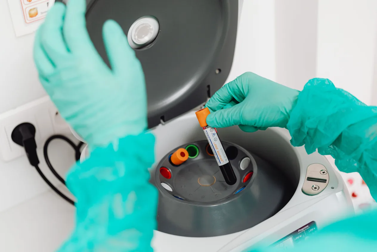 Plasma riche en plaquettes (PRP)